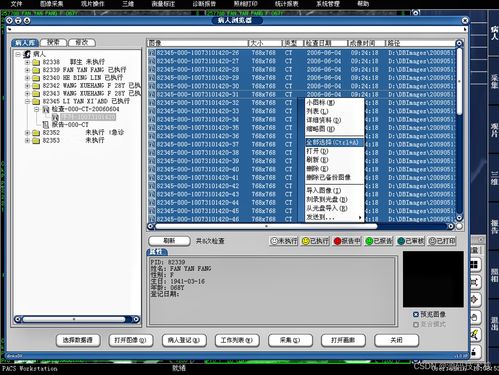醫學影像信息系統(PACS)源碼基礎解析 架構、原理與數據處理服務